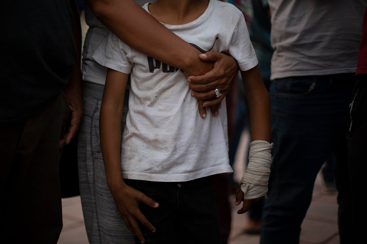 Karla Matute, 35, holds her son Joryí, 7,  in a crowd outside El Parque Bicentenario in Tapachula, Mexico, on March 5. Joryí’s arm was injured in a clash  outside an immigration office, and Matute has struggled to get him medical care. (Photo by Taylor Bayly/Cronkite Borderlands Project)
