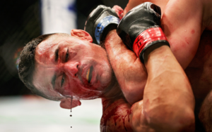 Las lesiones son una parte inherente del mundo de las artes marciales mixtas, y luchadores como Douglas Silva de Andrade a menudo entrenan en exceso como medida preventiva. (Foto de Carmen Mandato/Getty Images)