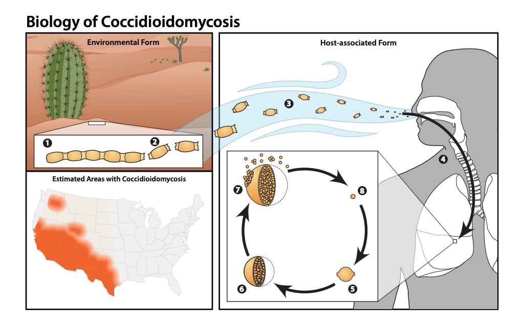 Biology of coccidioidomycosis.  (Graphics courtesy of CDC)